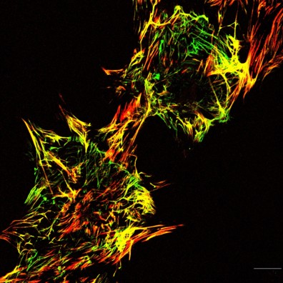 Fibronectin fibrils assembled by fibroblasts and imaged by fluorescence microscopy